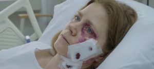 Gros plan sur le visage d'Amy Adams sur un lit d'hopital, l'oeil gauche victime d'un large bleu, issu du film La Femme à la Fenêtre.